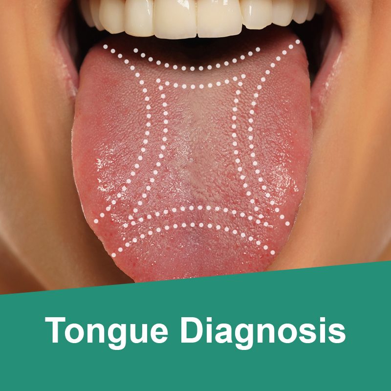 Tongue Diagnosis