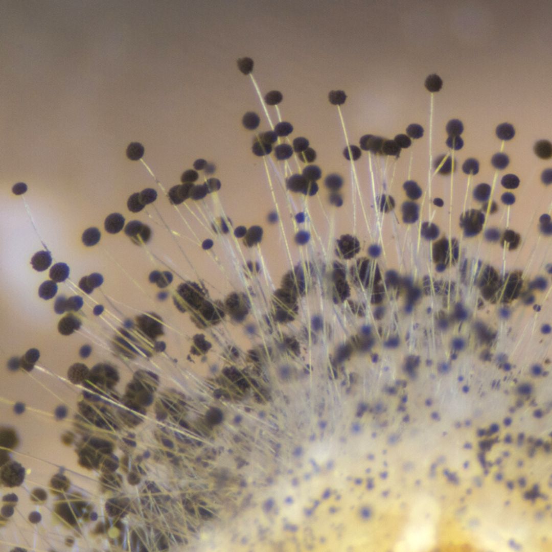 Mycotoxins in clinical practice - testing and therapeutics